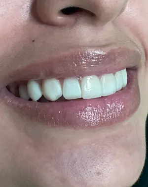 300x380 retrato — caso sorriso 2