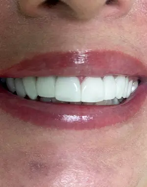 300x380 retrato — caso sorriso 3