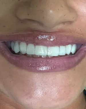 300x380 retrato — caso sorriso 4