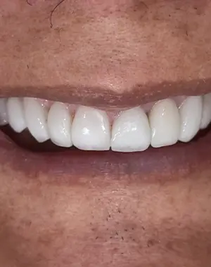 300x380 retrato — caso sorriso 7